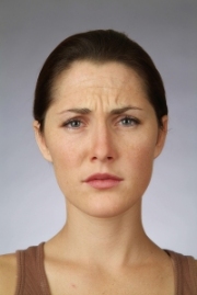 Gloucestershire Cosmetic Treatments- Before 